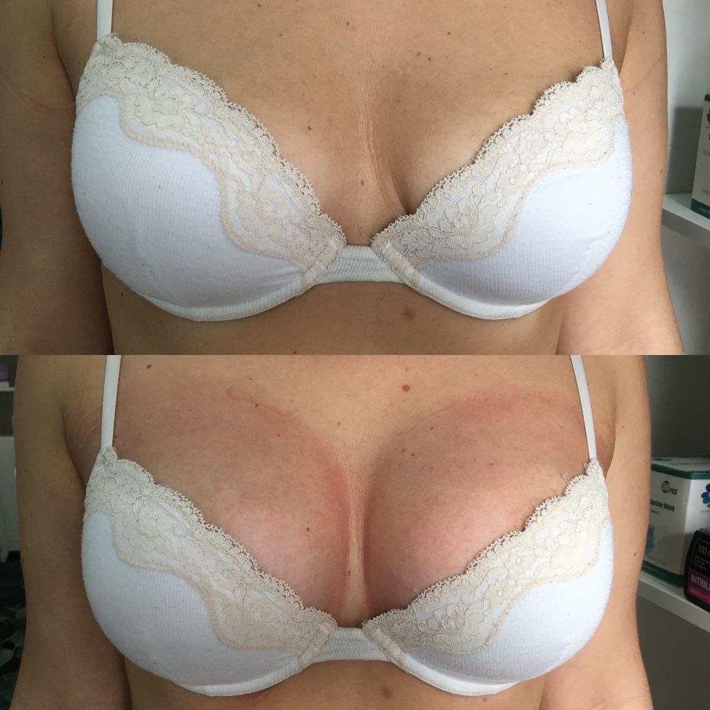 How to Get Bigger Breasts Without Surgery? Non-Invasive Non- Surgical –  Rema's Secrets Luxury Day Spa Body Sculpting Massage Skin Care Day Spa